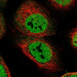 CEP128 Antibody, Novus Biologicals:Antibodies:Primary Antibodies