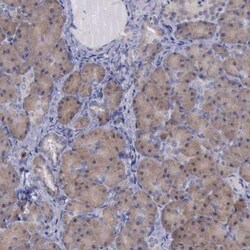 CEP128 Antibody, Novus Biologicals 25 &mu;L; Unlabeled:Antibodies, Polyclonal