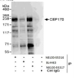 CEP170 Antibody, Novus Biologicals 0.1mL; Unlabeled:Antibodies, Polyclonal