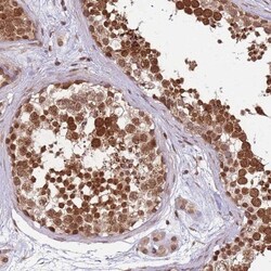 CEP170 Antibody, Novus Biologicals 0.1mL; Unlabeled:Antibodies, Polyclonal