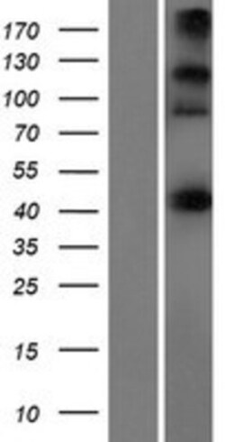 Novus Biologicals&trade;&nbsp;CEP44 Overexpression Lysate