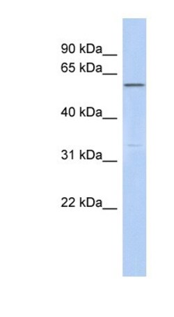 CEP57L1 Antibody, Novus Biologicals:Antibodies:Primary Antibodies