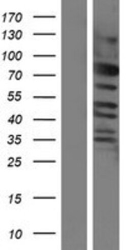 Novus Biologicals&trade;&nbsp;CEP57L1 Overexpression Lysate