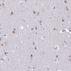 CEP72 Antibody, Novus Biologicals 25 &mu;L | Buy Online | Novus Biologicals | Fisher Scientific