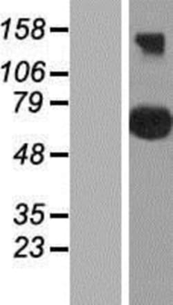 Novus Biologicals&trade;&nbsp;CEP76 Overexpression Lysate