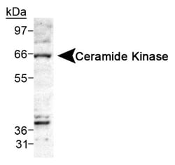 Ceramide Kinase Antibody, Novus Biologicals:Antibodies:Primary Antibodies