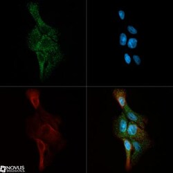 Ceramide Kinase Antibody, Novus Biologicals:Antibodies:Primary Antibodies