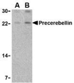 Cerebellin-1/Precerebellin Antibody - BSA Free, Novus Biologicals:Antibodies:Primary