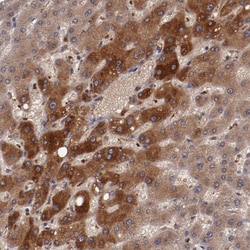 Ceruloplasmin Antibody, Novus Biologicals:Antibodies:Primary Antibodies