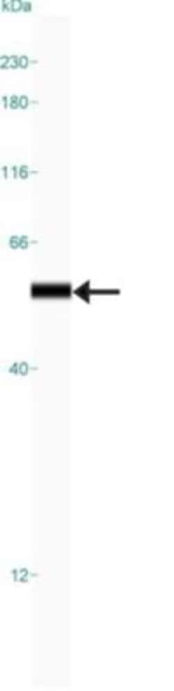 Carboxylesterase 1/CES1 Antibody, Novus Biologicals:Antibodies:Primary