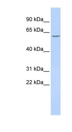 CES7 Antibody, Novus Biologicals 100&mu;L; Unlabeled:Antibodies, Polyclonal