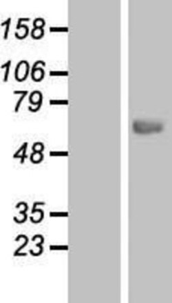 Novus Biologicals&trade;&nbsp;CES7 Overexpression Lysate
