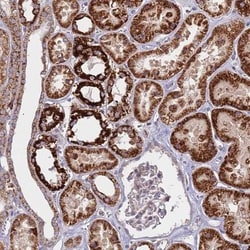 CES7 Antibody, Novus Biologicals 0.1mL; Unlabeled:Antibodies, Polyclonal