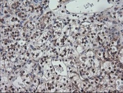 CESK1 Antibody (OTI1C1), Novus Biologicals 0.1mL; Unlabeled:Antibodies,