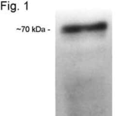 CETP Antibody (ATM192) - BSA Free, Novus Biologicals 0.025 mL, Unconjugated:Anticuerpos