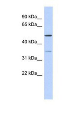 CETP Antibody, Novus Biologicals:Antibodies:Primary Antibodies