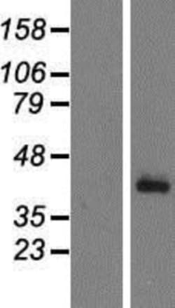 Novus Biologicals&trade;&nbsp;Complement Factor H-related 1/CFHR1/CFHL1 Overexpression Lysate