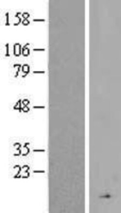 Novus Biologicals&trade;&nbsp;Complement Factor H-related 4/CFHR4 Overexpression Lysate
