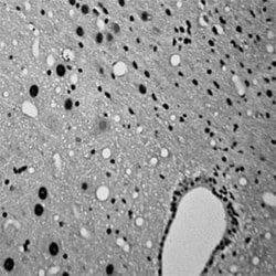 c-Fos Antibody, Novus Biologicals:Antibodies:Primary Antibodies