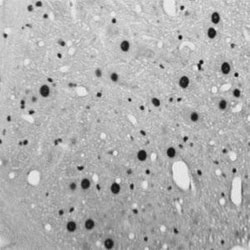 c-Fos Antibody, Novus Biologicals:Antibodies:Primary Antibodies