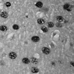 c-Fos Antibody, Novus Biologicals:Antibodies:Primary Antibodies