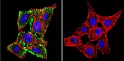 CFTR Antibody (CF3), Novus Biologicals 0.1mL; Unlabeled:Antibodies, Monoclonal