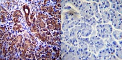 CFTR Antibody (CF3), Novus Biologicals 0.1mL; Unlabeled:Antibodies, Monoclonal