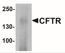 CFTR Antibody - BSA Free, Novus Biologicals:Antibodies:Primary Antibodies