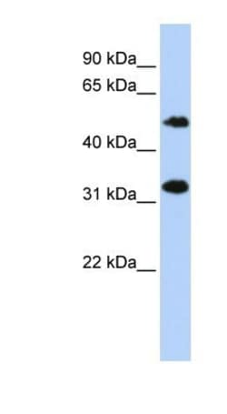 cGAS Antibody, Novus Biologicals 0.05mg; Unlabeled:Antibodies, Polyclonal