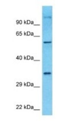 cGAS Antibody, Novus Biologicals 0.05mg; Unlabeled:Antibodies, Polyclonal