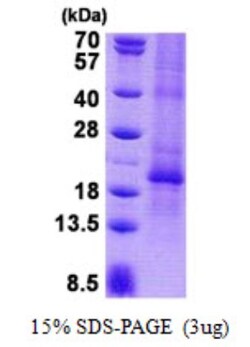 Novus Biologicals&trade;&nbsp;Recombinant Human CGB2 His Protein