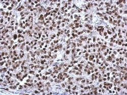 CGGBP1 Antibody, Novus Biologicals 0.1mL; Unlabeled:Antibodies, Polyclonal