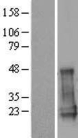 Novus Biologicals&trade;&nbsp;CGGBP1 Overexpression Lysate
