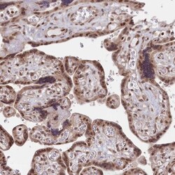 CGGBP1 Antibody, Novus Biologicals 0.1mL; Unlabeled:Antibodies, Polyclonal
