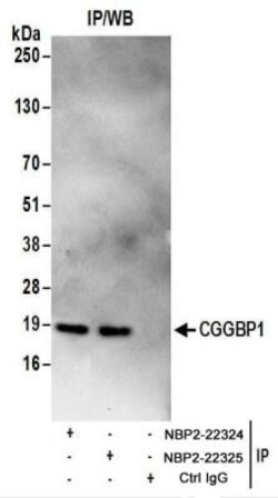 CGGBP1 Antibody, Novus Biologicals 0.1mg; Unlabeled:Antibodies, Polyclonal