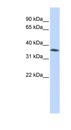 CGI 62 Antibody, Novus Biologicals 100 &mu;L | Buy Online | Novus Biologicals | Fisher Scientific