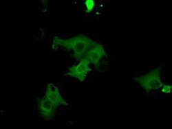 cGK1/PRKG1 Antibody (OTI9G4), Novus Biologicals 0.1mL; Unlabeled:Antibodies,