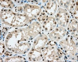 cGK1/PRKG1 Antibody (OTI9G4), Novus Biologicals 0.1mL; Unlabeled:Antibodies,