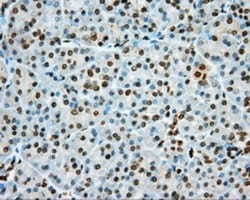 cGK1/PRKG1 Antibody (OTI9G4), Novus Biologicals 0.1mL; Unlabeled:Antibodies,