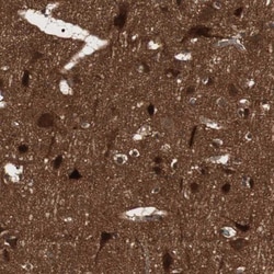 cGK2/PRKG2 Antibody, Novus Biologicals:Antibodies:Primary Antibodies