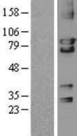 Novus Biologicals&trade;&nbsp;cGK2/PRKG2 Overexpression Lysate