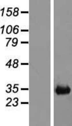 Novus Biologicals&trade;&nbsp;CH25H Overexpression Lysate