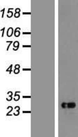 Novus Biologicals&trade;&nbsp;CHAC1 Overexpression Lysate