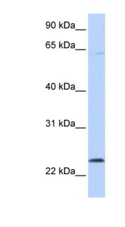 CHAC1 Antibody, Novus Biologicals 0.05mg; Unlabeled:Antibodies, Polyclonal