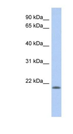 CHAC2 Antibody, Novus Biologicals 100&mu;L; Unlabeled:Antibodies, Polyclonal