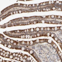 CHADL Antibody, Novus Biologicals 25 &mu;L | Buy Online | Novus Biologicals | Fisher Scientific