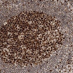 CHAF1B Antibody, Novus Biologicals 25 &mu;L; Unlabeled:Antibodies, Polyclonal