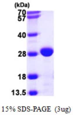 Novus Biologicals&trade;&nbsp;Recombinant E. coli Chaperone protein FimC His Protein