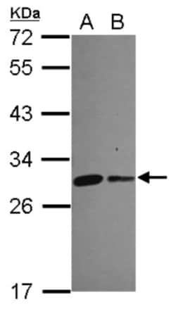 CHCHD3 Antibody, Novus Biologicals 0.1mL; Unlabeled:Antibodies, Polyclonal
