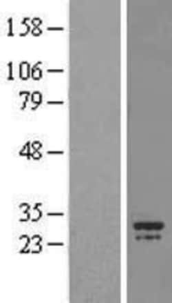 Novus Biologicals&trade;&nbsp;CHCHD3 Overexpression Lysate
